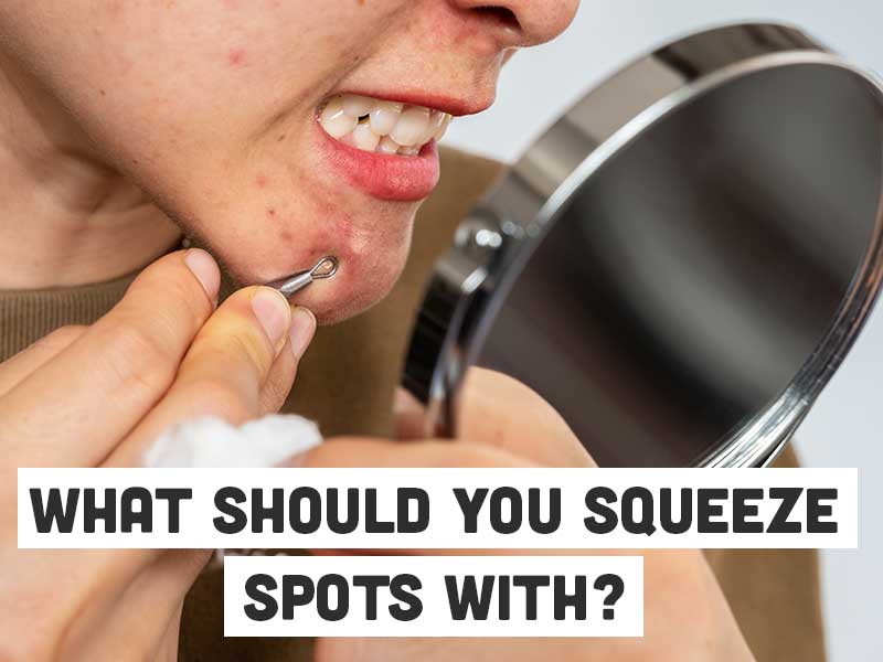 Should you squeeze spots